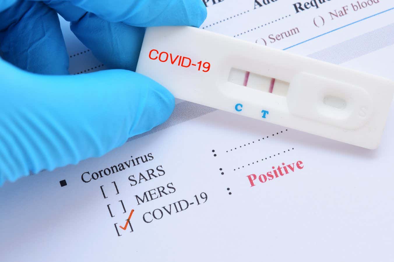 XEC: Lo que sabemos sobre la nueva variante del covid-19 y sus síntomas