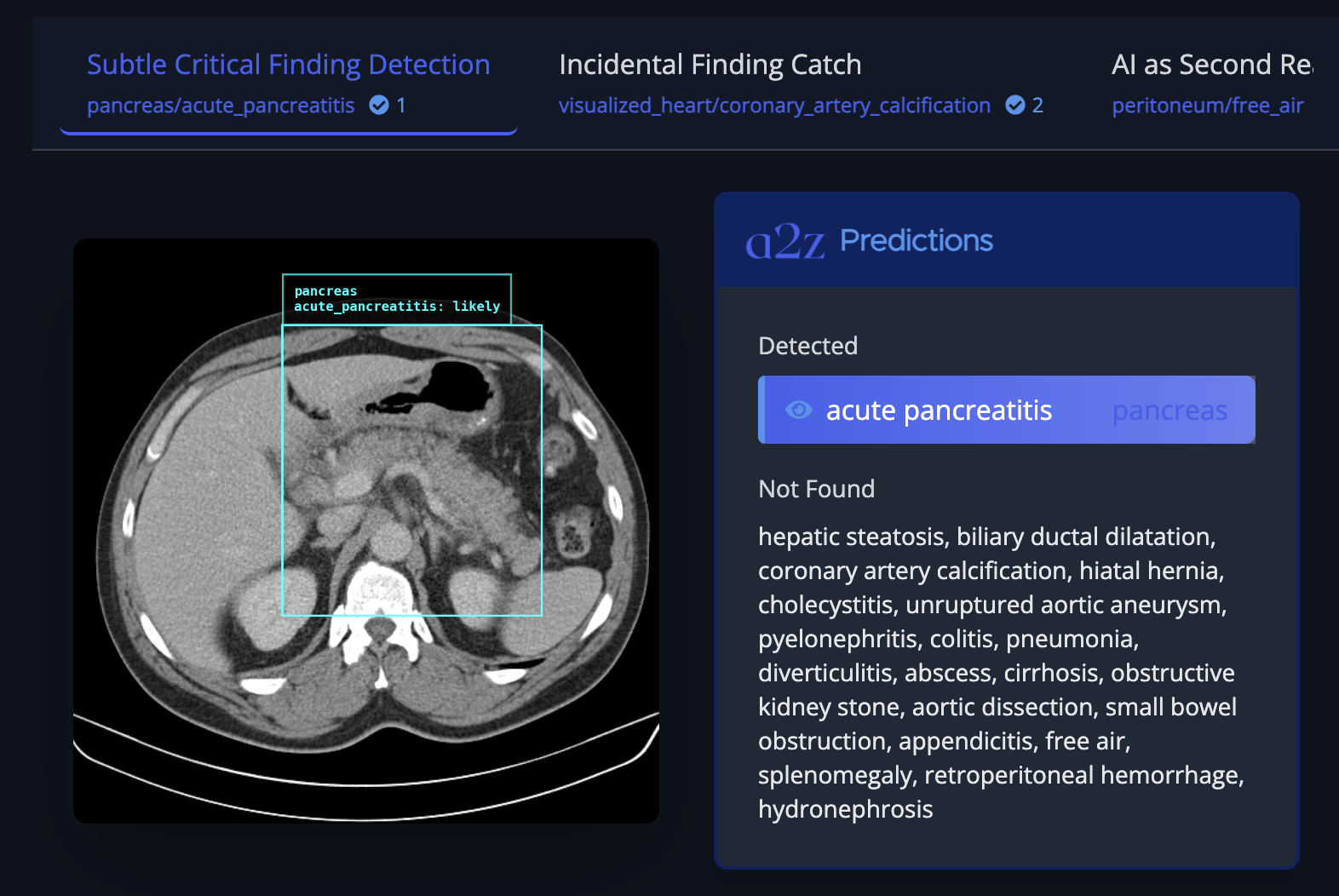 a2z Radiology AI presenta a2z-1: una IA que analiza tomografías computarizadas de pelvis abdominal e informes para detectar posibles errores en 21 condiciones